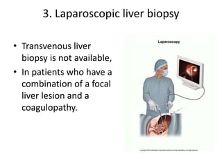 3. Laparoscopic liver biopsy
• Transvenous liver
biopsy is not available,
• In patients who have a
combination of a focal
liver lesion and a
coagulopathy.
 