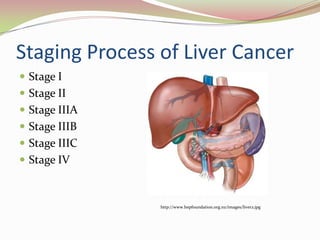 Liver Cancer