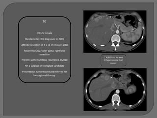 TG


               39 y/o female

    Fibrolamellar HCC diagnosed in 2001

Left lobe resection of 9 x 11 cm mass in 2001

  Recurrence 2007 with partial right lobe
               resection
                                                CT 4/9/2010: At least
Presents with multifocal recurrence 2/2010      10 hypervascular liver
                                                       masses
   Not a surgical or transplant candidate

 Presented at tumor board and referred for
           locoregional therapy
 