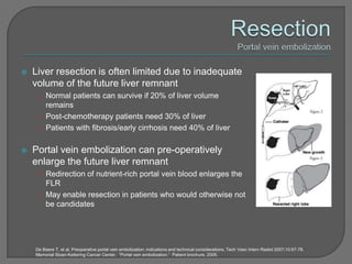    Liver resection is often limited due to inadequate
    volume of the future liver remnant
     • Normal patients can survive if 20% of liver volume
       remains
     • Post-chemotherapy patients need 30% of liver
     • Patients with fibrosis/early cirrhosis need 40% of liver


   Portal vein embolization can pre-operatively
    enlarge the future liver remnant
     • Redirection of nutrient-rich portal vein blood enlarges the
       FLR
     • May enable resection in patients who would otherwise not
       be candidates




    De Baere T, et al. Preoperative portal vein embolization: indications and technical considerations. Tech Vasc Interv Radiol 2007;10:67-78.
    Memorial Sloan-Kettering Cancer Center. “Portal vein embolization.” Patient brochure, 2005.
 