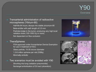    Transarterial administration of radioactive
    microspheres (Yttrium-90)
     • Half-life 64 hours; decays into stable zirconium-90
     • Beta-emitter with path length of 2.5 mm
     • Particles lodge in the tumor, producing very high local
       radiation dose (100-1000 Gy or more)
     • Not dependent on flow occlusion


   TheraSpheres
     • FDA approved under Humanitarian Device Exemption
       for use in treatment of HCC
     • Glass particle, 15-35 micron diameter
     • 1.2-8 million spheres per vial (3GBq)
     • Minimally embolic


   Two scenarios must be avoided with Y90
     • Shunting into lung (radiation pneumonitis)
     • Nontarget embolization of GI tract (ulceration)
 