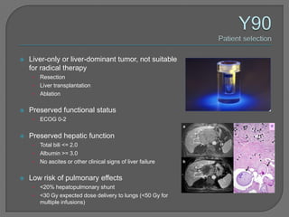    Liver-only or liver-dominant tumor, not suitable
    for radical therapy
     • Resection
     • Liver transplantation
     • Ablation


   Preserved functional status
     •   ECOG 0-2


   Preserved hepatic function
     • Total bili <= 2.0
     • Albumin >= 3.0
     • No ascites or other clinical signs of liver failure


   Low risk of pulmonary effects
     • <20% hepatopulmonary shunt
     • <30 Gy expected dose delivery to lungs (<50 Gy for
       multiple infusions)
 