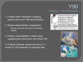 1. 2 weeks after mesenteric mapping,
   patient returns for Y90 administration

2. Repeat celiac/hepatic angiography
    • Ensure continued occlusion of embolized
      vessels


3. Position microcatheter in lobar artery
   supplying the most tumor and infuse Y90

4. If bilobar disease, patient will return in 1
month for Y90 treatment of opposite lobe
 