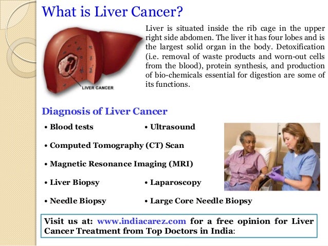 Liver cancer treatment in india