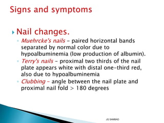  Nail changes.
◦ Muehrcke's nails - paired horizontal bands
separated by normal color due to
hypoalbuminemia (low production of albumin).
◦ Terry's nails - proximal two thirds of the nail
plate appears white with distal one-third red,
also due to hypoalbuminemia
◦ Clubbing - angle between the nail plate and
proximal nail fold > 180 degrees
JG SAMBAD
 