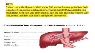 TIPPS
A shunt is an artificial passage which allows fluid to move from one part of your body
to another. A transjugular intrahepatic portosystemic shunt (TIPS) connects the vein
which brings blood from your gastrointestinal tract and intra-abdominal organs to your
liver, and the vein from your liver to the right part of your heart.
 