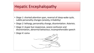Hepatic Encephalopathy
• Stage 1: shorted attention span, reversal of sleep-wake cycle,
subtle personality changes (anxiety, irritability)
• Stage 2: lethargy, personality change, disorientation. Asterixis.
• Stage 3: stupor but responsive, severe confusion and
disorientation, abnormal behaviour, incomprehensible speech
• Stage 4: coma
 