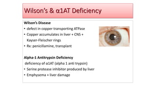 Wilson’s & α1AT Deficiency
Wilson’s Disease
• defect in copper transporting ATPase
• Copper accumulates in liver + CNS +
Kayser-Fleischer rings
• Rx: penicillamine, transplant
Alpha-1 Antitrypsin Deficiency
deficiency of α1AT (alpha 1 anti trypsin)
• Serine protease inhibitor produced by liver
• Emphysema + liver damage
 