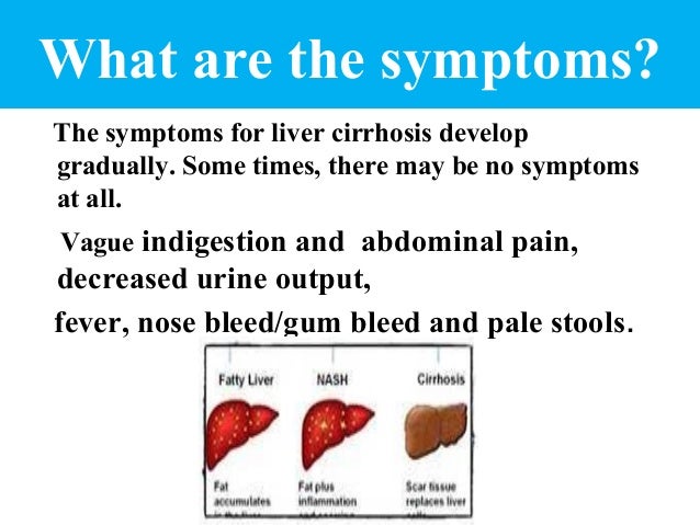 What is liver cirrhosis?