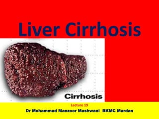Liver Cirrhosis
Lecture 19
Dr Mohammad Manzoor Mashwani BKMC Mardan
 