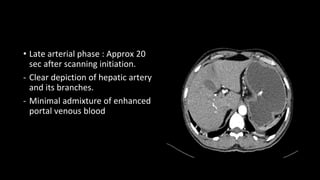 • Late arterial phase : Approx 20
sec after scanning initiation.
- Clear depiction of hepatic artery
and its branches.
- Minimal admixture of enhanced
portal venous blood
 