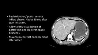• Redistribution/ portal venous
inflow phase : About 30 sec after
scan initiation.
- Allows early visualisation of
portal vein and its intrahepatic
branches.
- Maximum contrast enhancement
after 40sec.
 