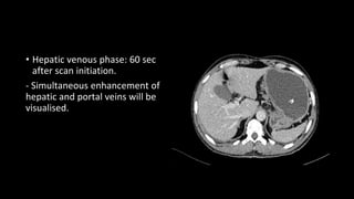 • Hepatic venous phase: 60 sec
after scan initiation.
- Simultaneous enhancement of
hepatic and portal veins will be
visualised.
 