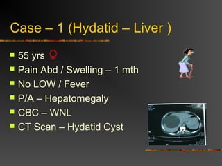 Case – 1 (Hydatid – Liver ) 
 55 yrs 
 Pain Abd / Swelling – 1 mth 
 No LOW / Fever 
 P/A – Hepatomegaly 
 CBC – WNL 
 CT Scan – Hydatid Cyst 
 