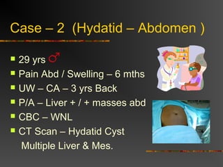 Case – 2 (Hydatid – Abdomen ) 
 29 yrs 
 Pain Abd / Swelling – 6 mths 
 UW – CA – 3 yrs Back 
 P/A – Liver + / + masses abd 
 CBC – WNL 
 CT Scan – Hydatid Cyst 
Multiple Liver & Mes. 
 