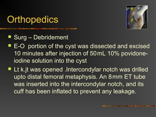 Orthopedics 
 Surg – Debridement 
 E-O portion of the cyst was dissected and excised 
10 minutes after injection of 50 mL 10% povidone-iodine 
solution into the cyst 
 Lt k.jt was opened .Intercondylar notch was drilled 
upto distal femoral metaphysis. An 8 mm ET tube 
was inserted into the intercondylar notch, and its 
cuff has been inflated to prevent any leakage. 
 