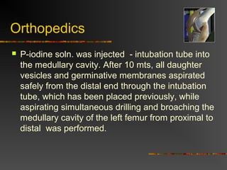 Orthopedics 
 P-iodine soln. was injected - intubation tube into 
the medullary cavity. After 10 mts, all daughter 
vesicles and germinative membranes aspirated 
safely from the distal end through the intubation 
tube, which has been placed previously, while 
aspirating simultaneous drilling and broaching the 
medullary cavity of the left femur from proximal to 
distal was performed. 
 