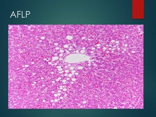 AFLP
 