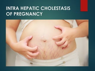 INTRA HEPATIC CHOLESTASIS
OF PREGNANCY
 