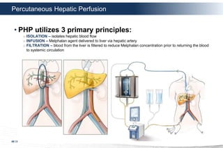66 DELCATH SYSTEMS, INC
Percutaneous Hepatic Perfusion
• PHP utilizes 3 primary principles:
o ISOLATION – isolates hepatic...