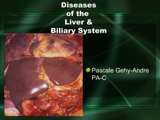 [object Object],Diseases of the  Liver & Biliary System 