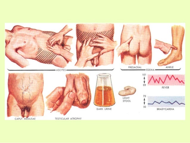 What does ALT (SGPT) mean in a blood test?