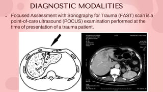Pocus Modality Liver Diseases_ Primary Biliary Cholangitis by Slidesgo.pptx