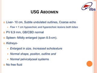 USG ABDOMEN
 Liver- 10 cm, Subtle undulated outlines, Coarse echo
 Few < 1 cm hypoechoic and hyperechoic lesions both lobes
 PV 6.9 mm, GB/CBD normal
 Spleen- Mildly enlarged (span 8.5-cm).
 Kidneys-
 Enlarged in size, Increased echotexture
 Normal shape, positon, outline and
 Normal pelvicalyceal systems
 No free fluid
 