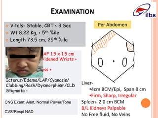 EXAMINATION
 Vitals- Stable, CRT < 3 Sec
 Wt 8.22 Kg, < 5th %ile
 Length 73.5 cm, 25th %ile
Per Abdomen
Liver-
•4cm BCM/Epi, Span 8 cm
•Firm, Sharp, Irregular
Spleen- 2.0 cm BCM
B/L Kidneys Palpable
No Free fluid, No Veins
CNS Exam: Alert, Normal Power/Tone
CVS/Respi NAD
Pallor +, Afebrile, AF 1.5 x 1.5 cm
Rachitic Rosary/Widened Wrists +
Periorbital Puffiness +
Icterus/Edema/LAP/Cyanosis/
Clubbing/Rash/Dysmorphism/CLD
Stigmata -
 