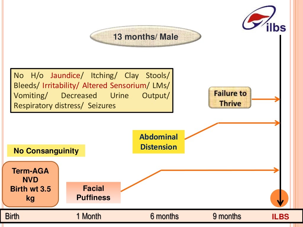 Liver failure in an infant dr. vikrant sood