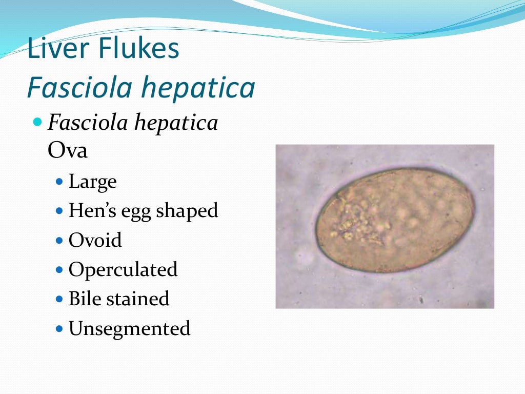 Liver flukes