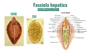 Liver flukes F. hepatica F. gigantica | PPTX