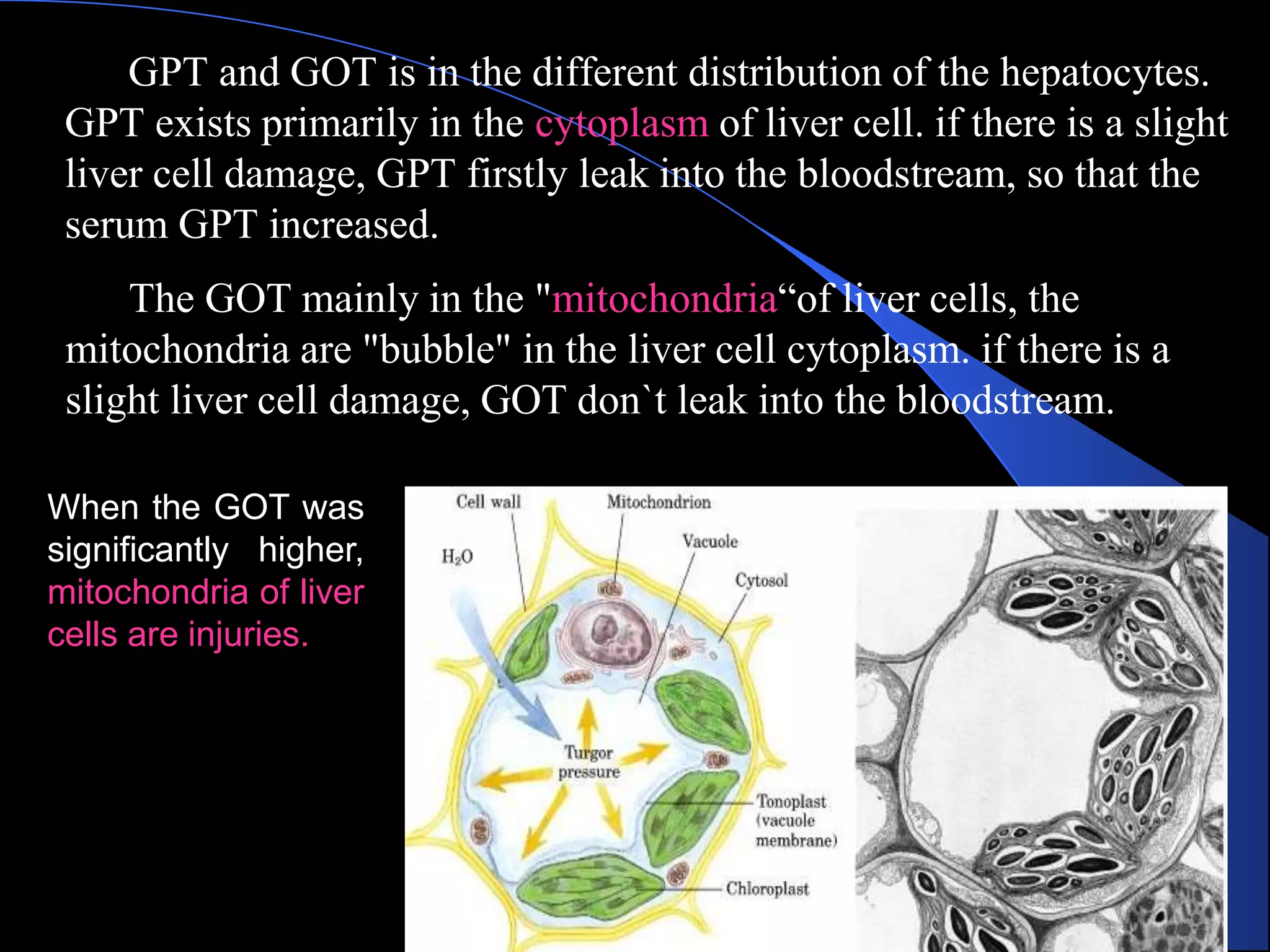 GPT and GOT is in the different distribution of the hepatocytes.
GPT exists primarily in the cytoplasm of liver cell. if there is a slight
liver cell damage, GPT firstly leak into the bloodstream, so that the
serum GPT increased.
The GOT mainly in the "mitochondria“of liver cells, the
mitochondria are "bubble" in the liver cell cytoplasm. if there is a
slight liver cell damage, GOT don`t leak into the bloodstream.
When the GOT was
significantly higher,
mitochondria of liver
cells are injuries.
 
