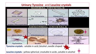 Urinary Tyrosine and Leucine crystals
Tyrosine crystals : soluble in acid /alcohol ,needle shaped
Leucine crystals : yellow spherical ,insoluble in acids ,soluble in alcohol
 