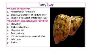 Fatty liver
❖Causes of Fatty liver
1. Abnormal fat formation
2. Excessive transport of lipids to liver
3. Impaired transport of fats from liver
❖Conditions associated with Fatty liver
a. Starvation
b. Diabetes Mellitus
c. Kwashiorkor
d. Pancreatomy
e. Excessive consumption of alcohol
f. Infections
g. Toxins
 