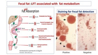 Fecal fat :LFT associated with fat metabolism
Staining for Fecal fat detection
 