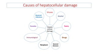 Causes of hepatocellular damage
Hepato
cellular
damage
Viruses
Alcohol
Toxins
Drugs
General
diseases
Neoplasm
Immunological
Parasites
Bacterial
infections
 