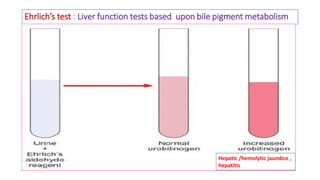 Ehrlich’s test : Liver function tests based upon bile pigment metabolism
Hepatic /hemolytic jaundice ,
hepatitis
 