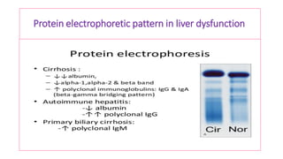 Protein electrophoretic pattern in liver dysfunction
 