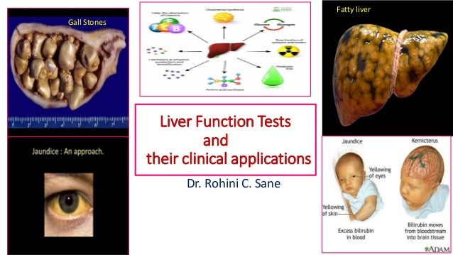 Liver Function Tests And Their Clinical Applications