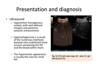 Presentation and diagnosis
• Ultrasound
– hyperechoic homogenous
nodule, with well-defined
margins and posterior
acoustic enhancement
– hyperechogenicity is a result
of the numerous interfaces
between the endothelial lined
sinuses composing the HH
and the blood within them.
– This hyperechoic appearance
is usually the case for small
HH
 