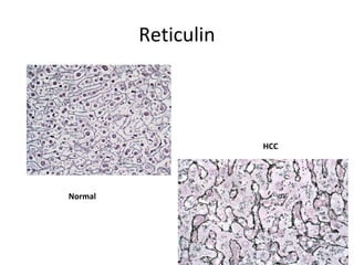Histology of normal liver | PPT