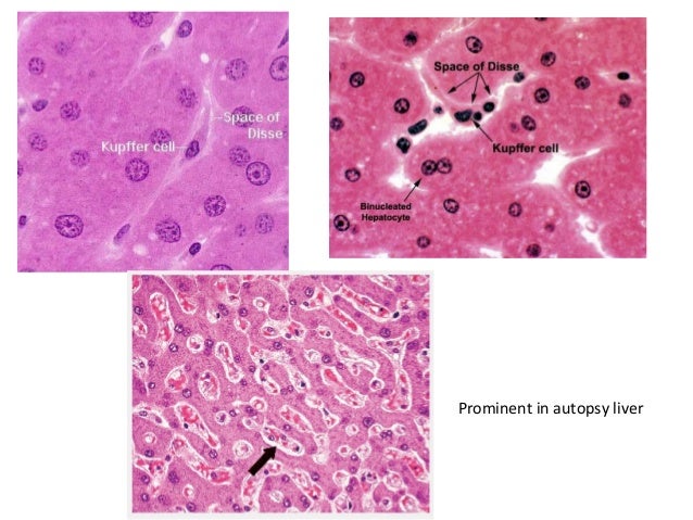 histology of normal liver liver histology labeled