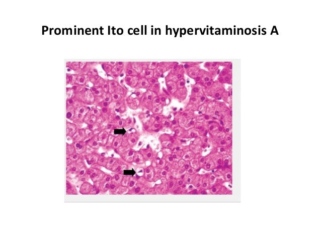 histology of normal liver liver histology labeled