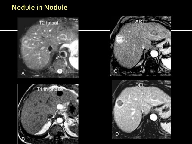 izen imaging mri ct scan usg xray interventions