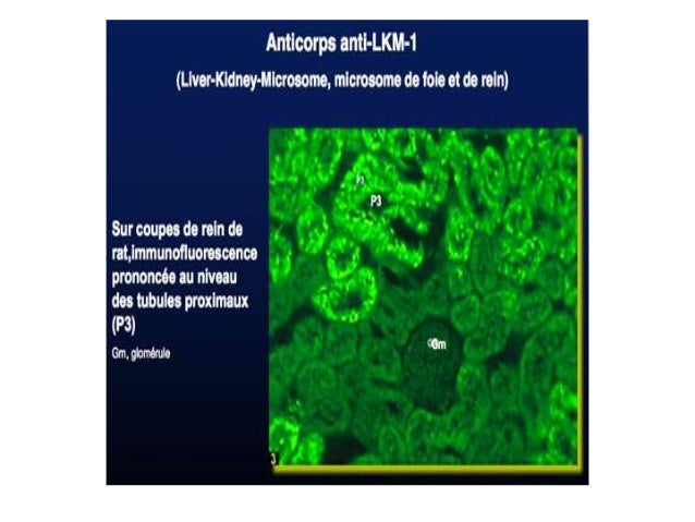 Anti Microsomal Ab High : What Does Elevated Anti-TPO Mean if Other ...