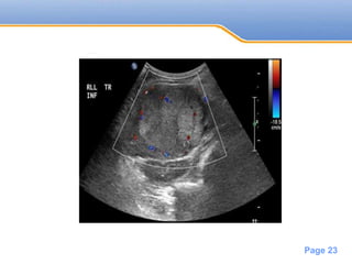 Powerpoint Templates
Page 23
 