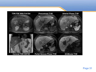 Powerpoint Templates
Page 31
 