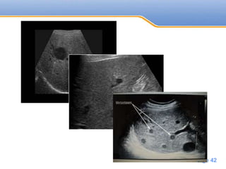 Powerpoint Templates
Page 42
 