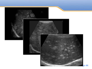 Powerpoint Templates
Page 44
 